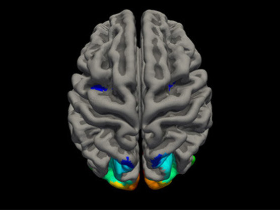 fMRI Lab