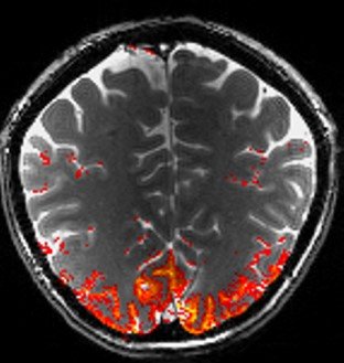 <p>Fingerprints of Neuronal Activation</p>